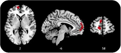 Coping with Childbirth: Brain Structural Associations of Personal Growth Initiative